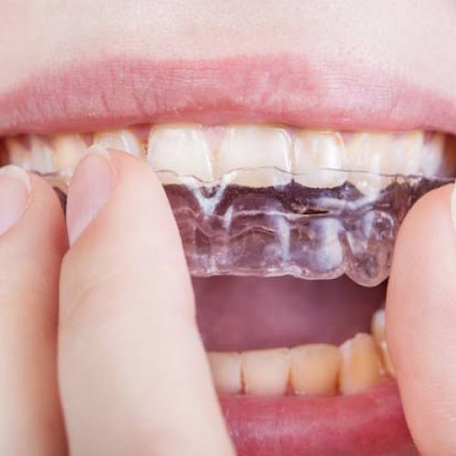 دندانسازي منطقه 4