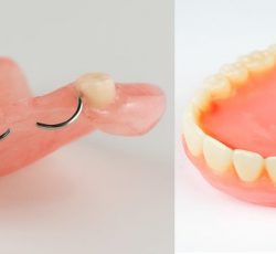 دندان سازي منطقه 4
