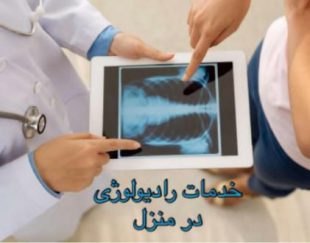 رادیولوژی در منزل در مشهد