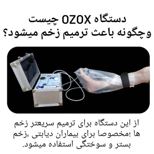 درمان زخم بستر و زخم دیابتی در خانه با دستگاه ozox انجام دهید.